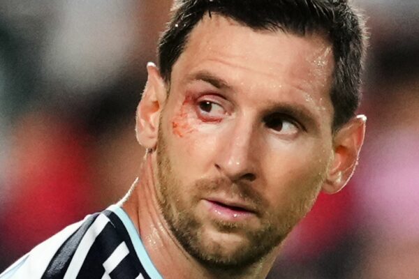 Wieder gezeichnet: Superstar Lionel Messi.